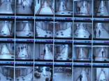 Bathroom Knife Attack Caught on School's Security Camera