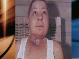 Sister of Patient, Lawyer Look Forward to Day in Court
