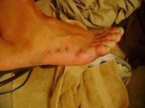 The Shoe Fits: Supreme Court Refuses to Hear Podiatrist Case