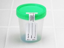 Scoop of Poop Could Save Your Life
