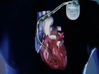 The Heart of the Matter