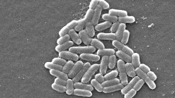 DuPage Identifies Restaurant Tied To E. Coli Outbreak