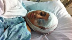 $18.5 M Settlement for Injured 'Transformers' Extra