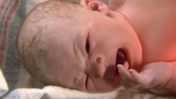 Elective C-sections Reduced