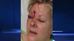 'Hawks Fan Hit by Puck in Game 1