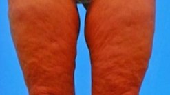 Another Way To Trim The Fat?