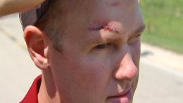 Grad Student Attacked by Pack of Kids