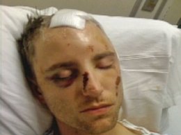 Madina Lake Bassist Hospitalized After Brutal Attack