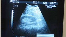 Va. House Passes Amended Pre-Abortion Ultrasound Bill