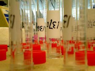 Backlogged: DNA Tests Sit, Crimes Continue