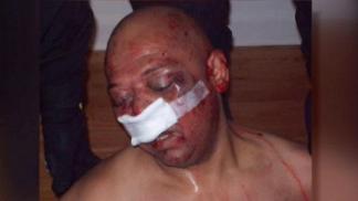 Victim's Mother Lashes Out in City Council Meeting