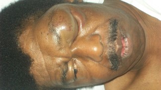 Allegations of Police Brutality Dog North Chicago