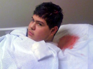 Family Claims Police Beat Autistic Boy