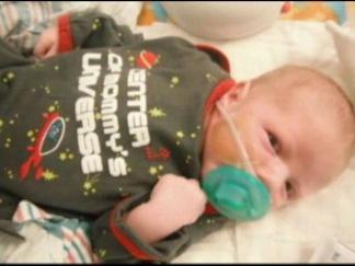 Baby Seth to Have Surgery Thursday