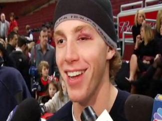 Kane's Black Eye: "Hopefully the Chicks Love It"