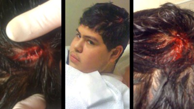 Council Allocates $525K to Settle Police Beating Case
