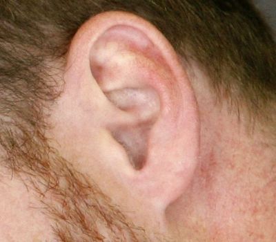 Cyclist Loses Chunk of His Ear in Road Rage Incident