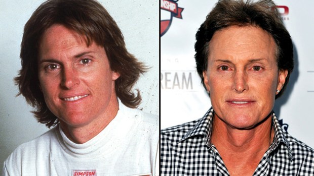 [NATL] Plastic Surgery: Celebrities Then and Now