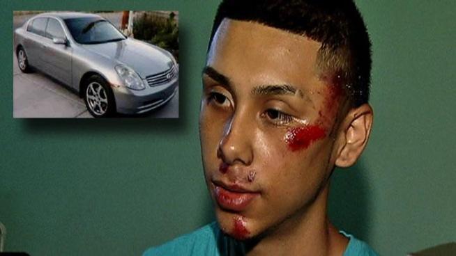 Edwin Rodriguez was injured during a carjacking outside the Wit hotel early Wednesday morning.