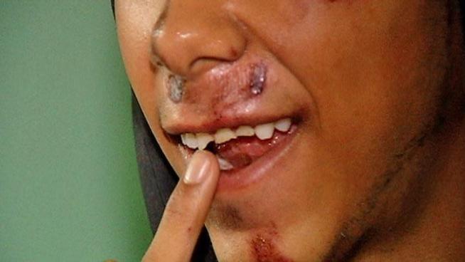 Edwin Rodriguez wound up with three busted teeth during a Wednesday morning carjacking.