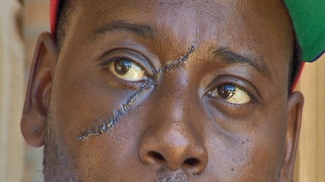 Elree Jones was brutally attacked shortly after stopping into a Lafayette, Ind., convenience store for a late-night beer run on Aug. 30.