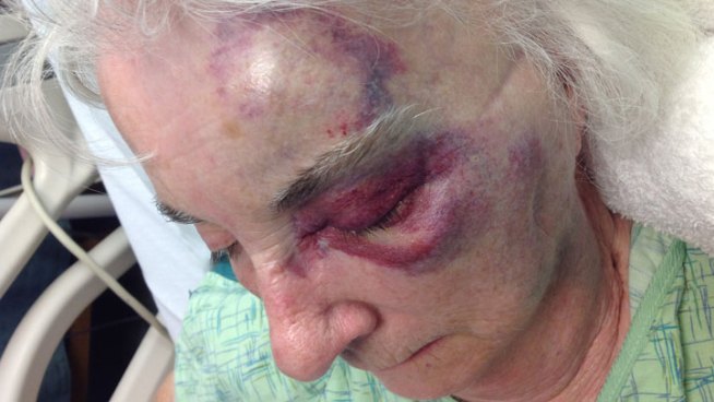 Frank Macchione, 86, was walking with his 82-year-old wife near the Hollywood Casino, at New York Street and Stolp Avenue, in Aurora, when a man grabbed Mary Macchione's purse and shoved her to the ground. Natalie Martinez reports.