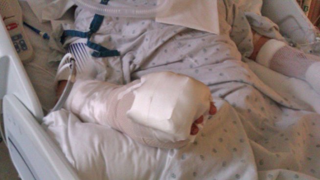 Anthony Kuber was seriously wounded when he was shot multiple times after two men robbed him of his coat, wallet and cell phone under an overpass in the South Side Fuller Park neighborhood Monday night. Kim Vatis spoke with his fiancée.