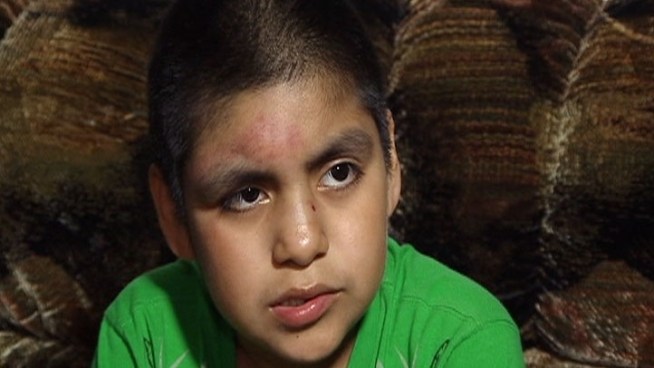 Everardo Patino, 10, was the most seriously injured of the students when an inflatable slide tipped over.