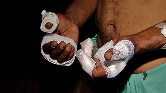 July 7, 2011: Driver LaRoyce Southall lost two fingertips while struggling to defend himself against a robber.
