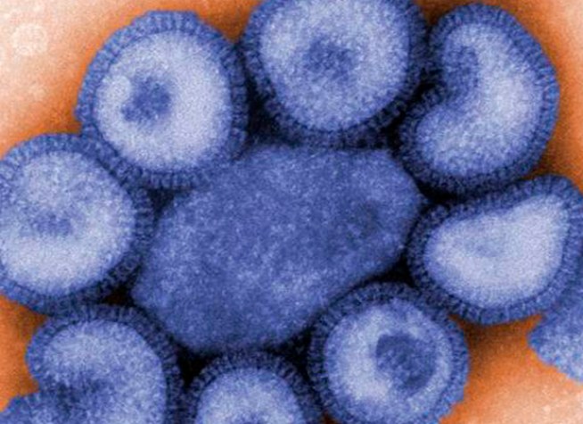 Child's Death is Illinois' 8th From Swine Flu