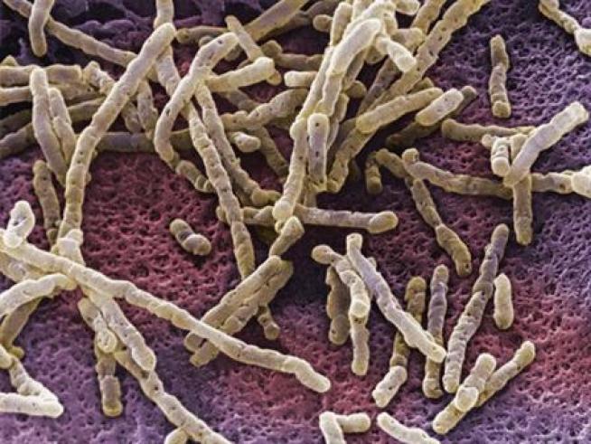 Doctors say a common bacteria is turning into dangerous infections, and people who take antibiotics are more at risk of getting it.
