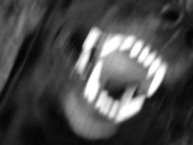 Boy Mauled by Dog Was About to Be Adopted
