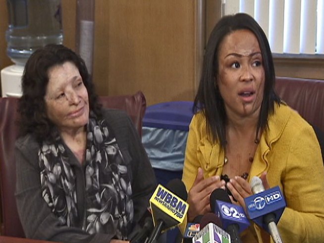 A pair of women who were severely burned in separate acid attacks are now fighting to prevent similar assaults in the future by working to limit access to the caustic substance that disfigured them.