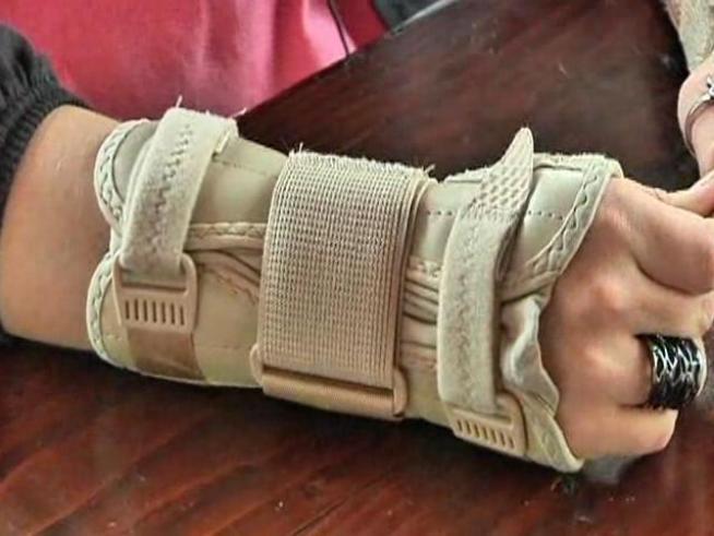 Annie Levitz, 16, texts on average of 4,000 texts a month now wears a brace for both wrists after being diagnosed with Carpal Tunnel Syndrome.