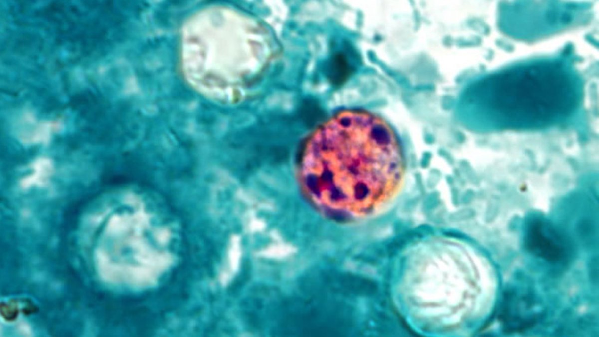 Stomach bug circulating in Oak Park schools, health department says