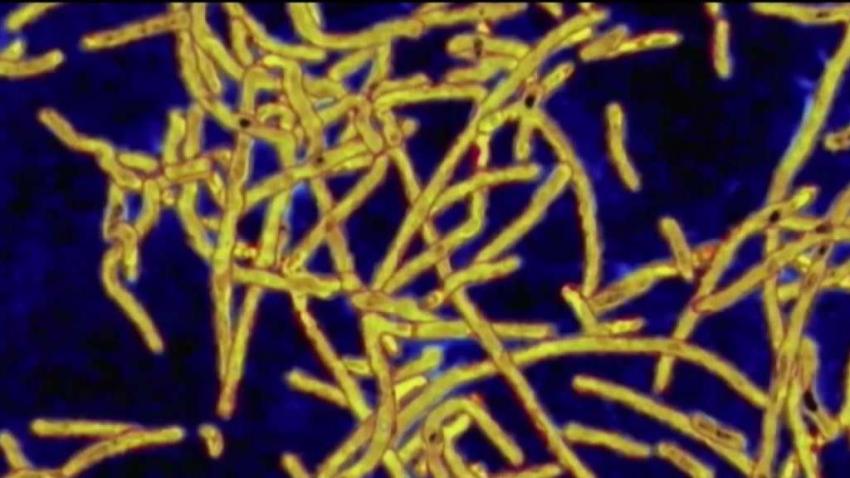 Boston_VA_Hospital_Patient_Infected_With_Legionnaires_.jpg