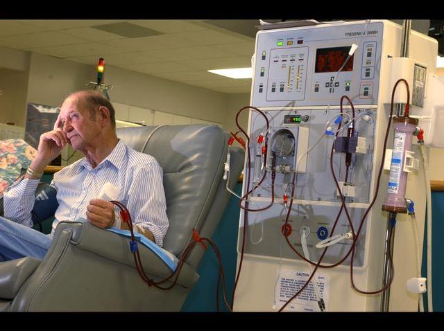 Dialysis