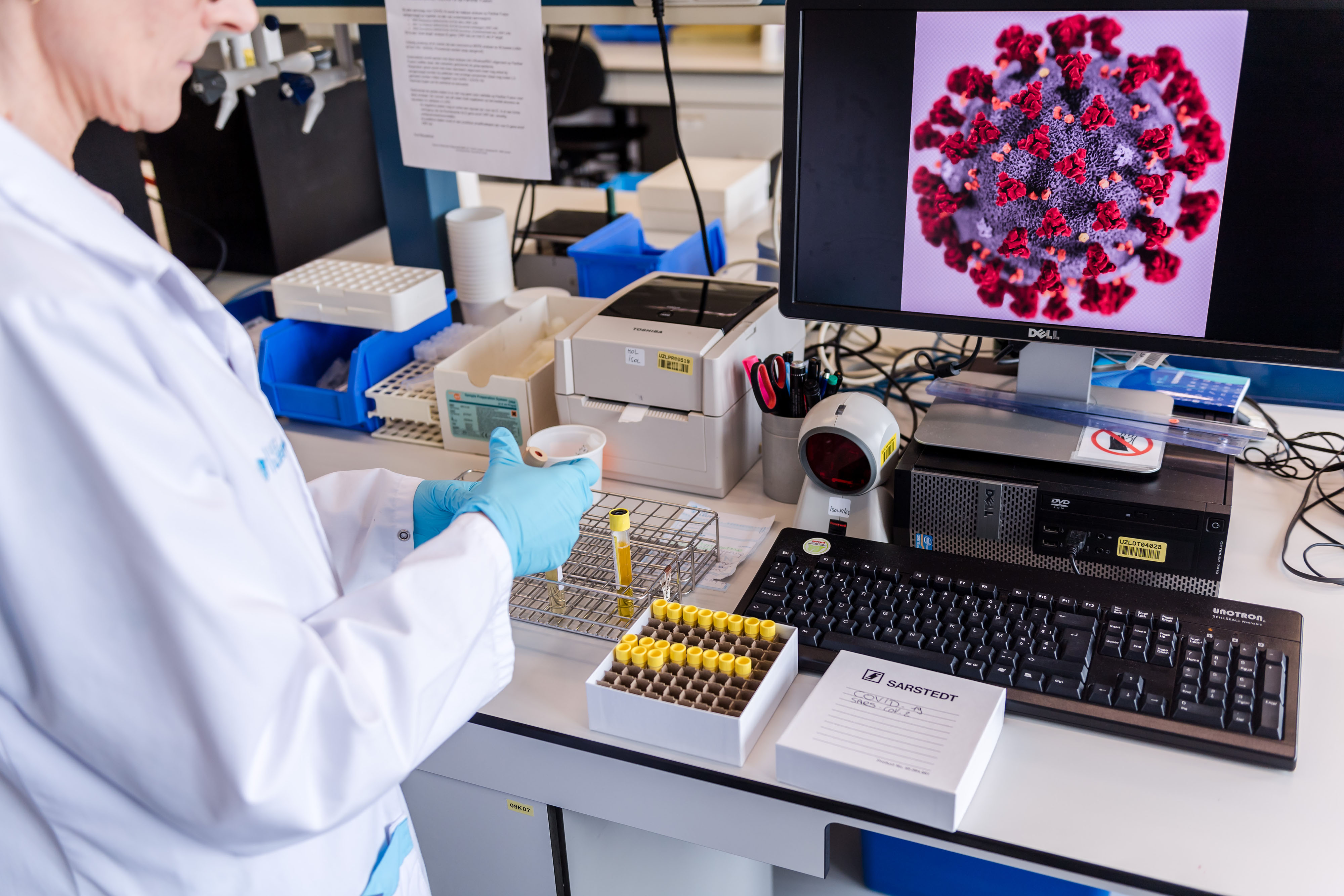 In this Feb. 28, 2020, file photo, a coronavirus patient sample detection test is seen in the virology research labs at UZ Leuven University Hospital in Leuven, Belgium.