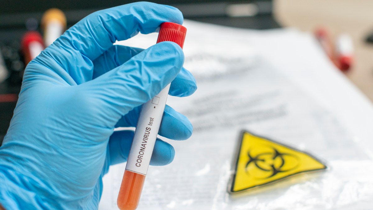 Illinois reports 5,343 new cases of coronavirus, 130 additional deaths Saturday – NBC Chicago