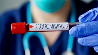 prueba de coronavirus