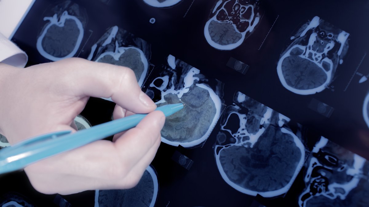 Groundbreaking study finds possible virus link to Parkinsons Disease