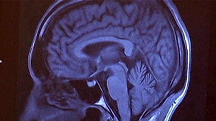 brain_scan_722x406_2214458385