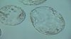 US fertility rate hits historic low as more families look to IVF