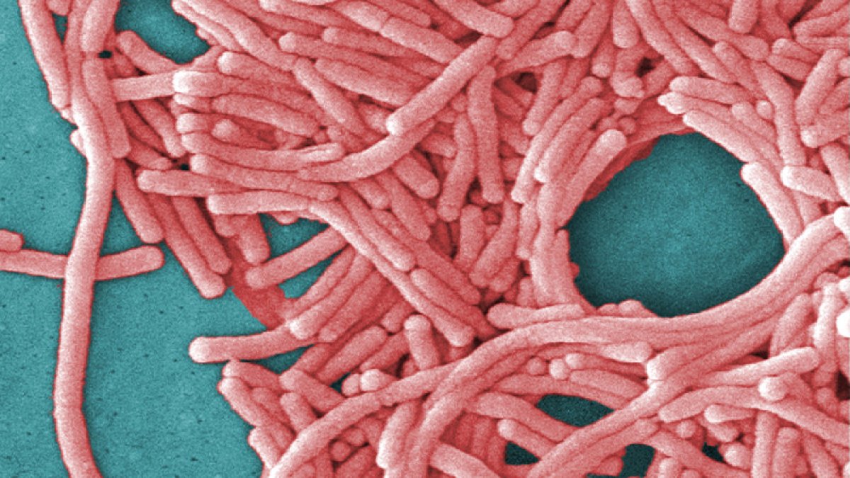 Wet summertime swelter causes spike in cases of Legionnaires' disease