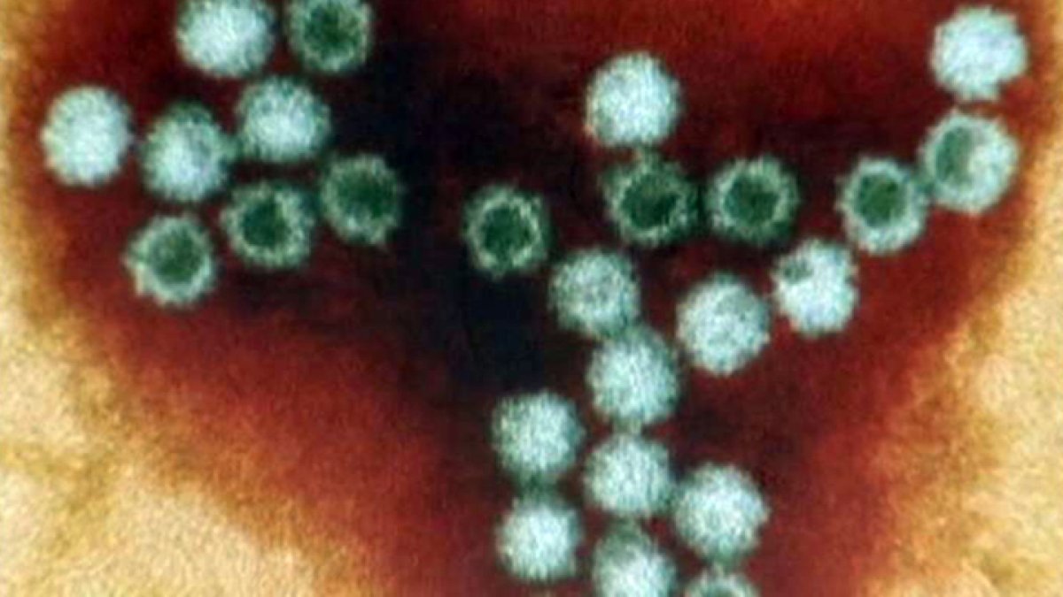 Expert Guidance on Norovirus Prevention as Cases Surge in the U.S.