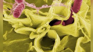 Salmonella bacteria