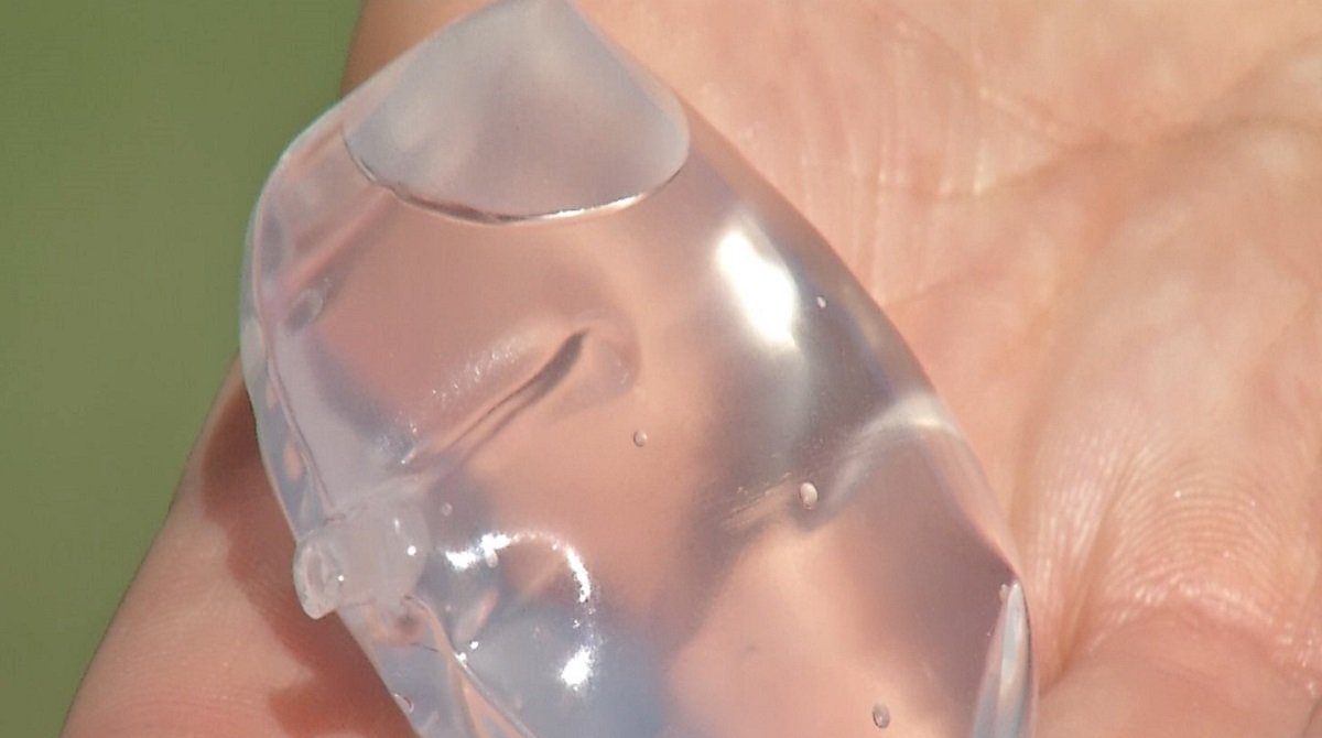 Baloon Spacwer Newly FDA-Approved Balloon Spacer Offers Alternative to Painful Rotator ...