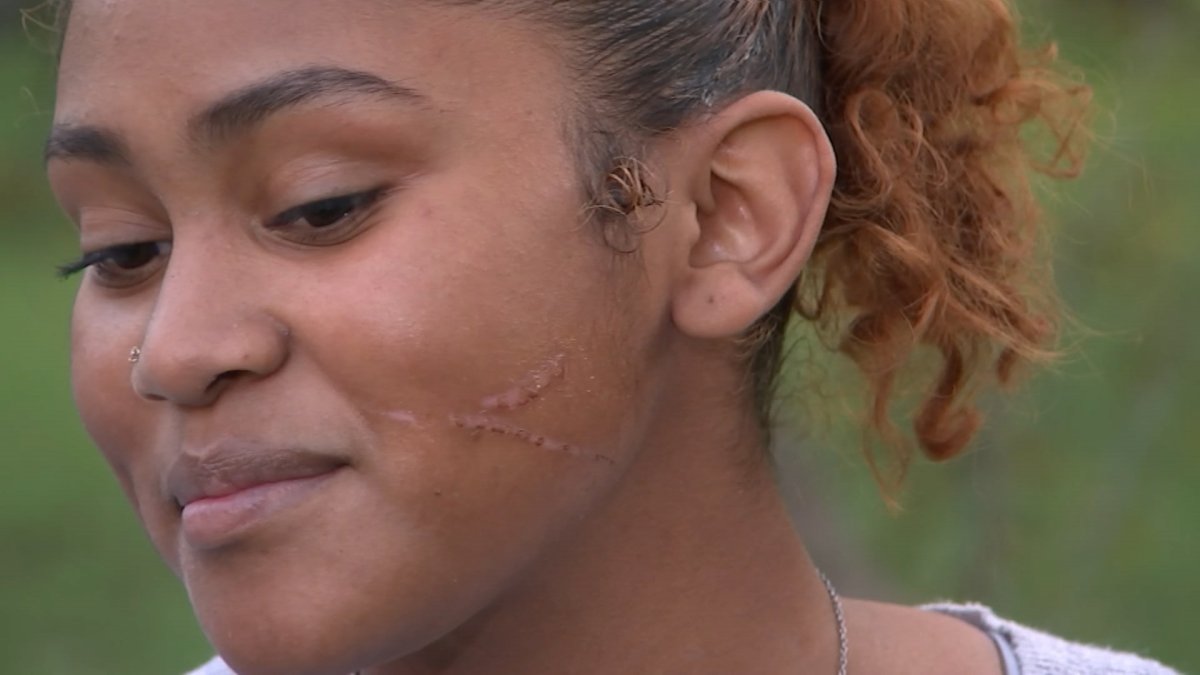 Teen Girl Allegedly Assaulted by Another Student, Parent at CPS Charter School - Vimarsana News