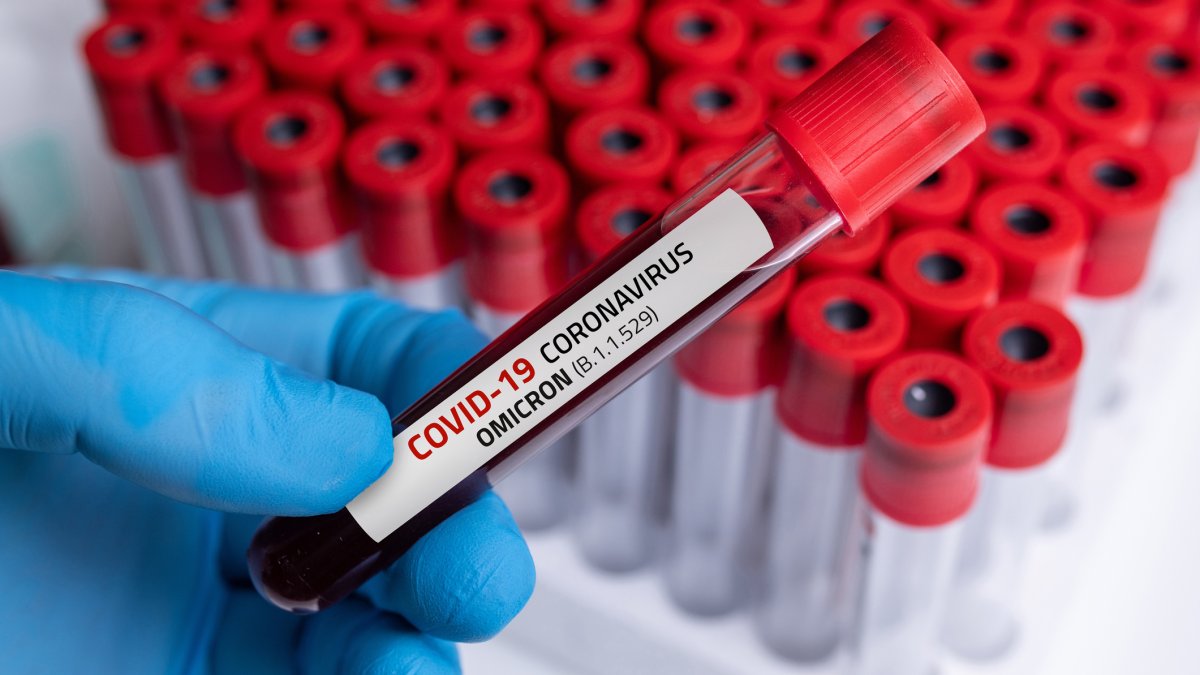 Photo of Infekcia COVID-19 po očkovaní môže vytvoriť „super imunitu“, zistila štúdia – NBC Chicago