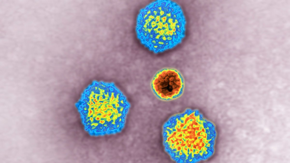 Illinois Among 25 States With Cases of Severe Hepatitis in Children - Vimarsana News